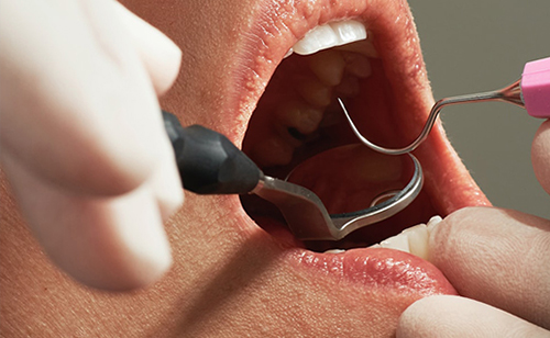 Dental Billing and Credentialing